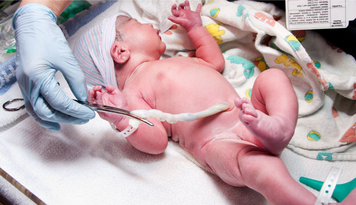 Bebé recién nacido con el cordón umbilical