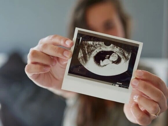 Desarrollo del feto: Mes a mes